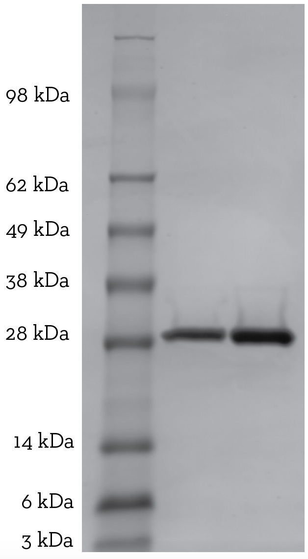 K48 Tetra-Ubiquitin